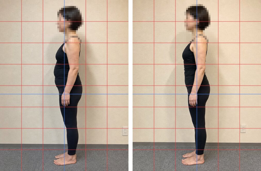 体型変化の再現イメージ。実際のお客様の写真ではありません。