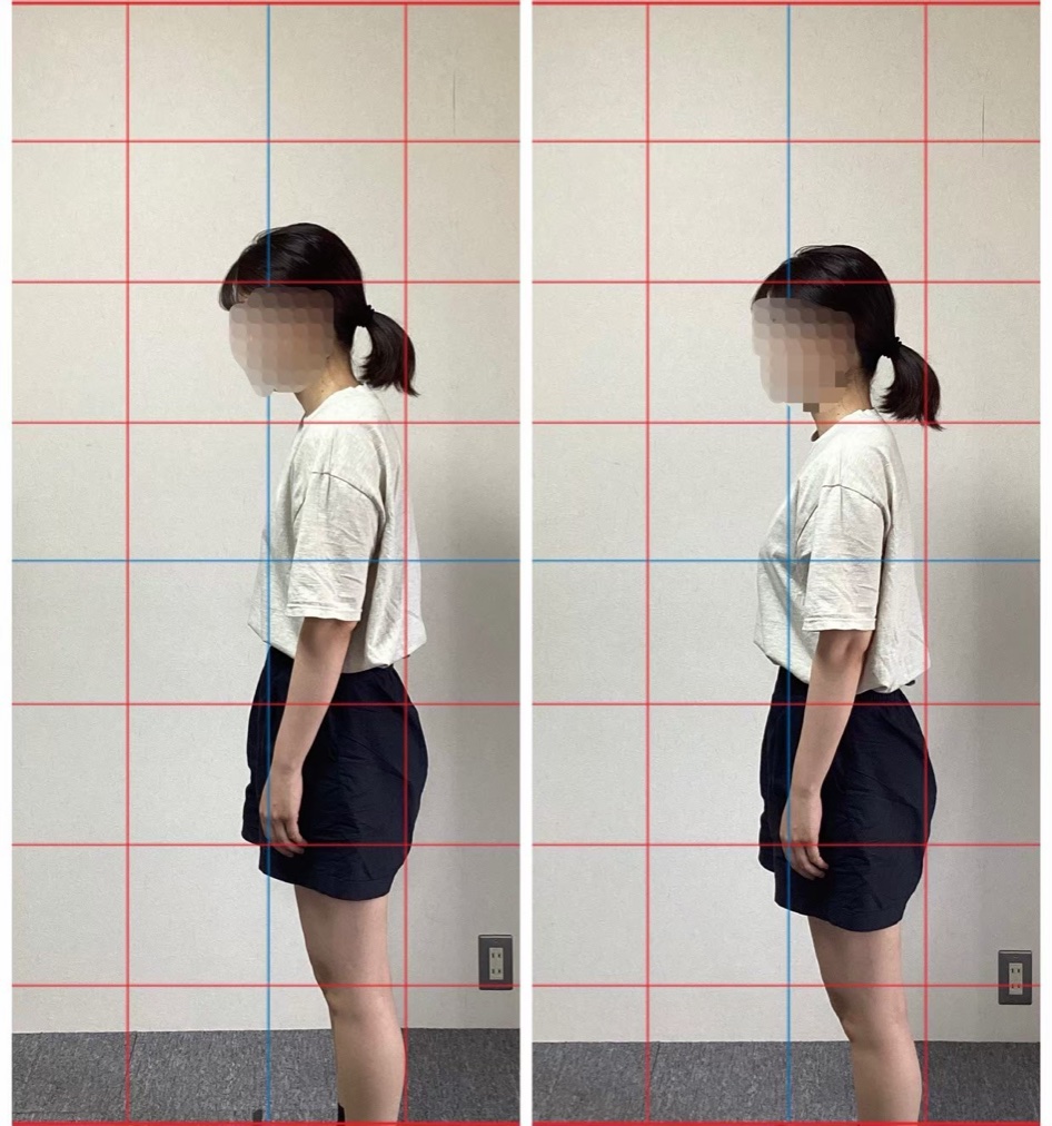 参照元掲載の姿勢の参考画像。頭が前に出る姿勢から、まっすぐな立ち姿へ
